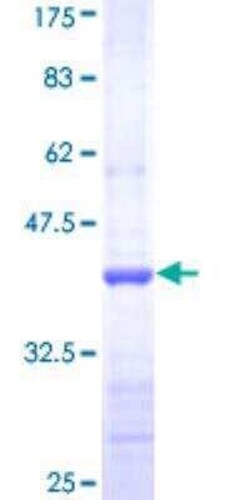Novus Biologicals Recombinant Human Adenylate Cyclase 5 GST (N-Term) Protein 2 &mu;g | Buy Online | Novus Biologicals&trade; | Fisher Scientific
