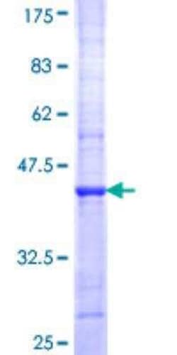 Novus Biologicals Recombinant Human Adenylate Cyclase 8 GST (N-Term) Protein 25 &mu;g | Buy Online | Novus Biologicals&trade; | Fisher Scientific