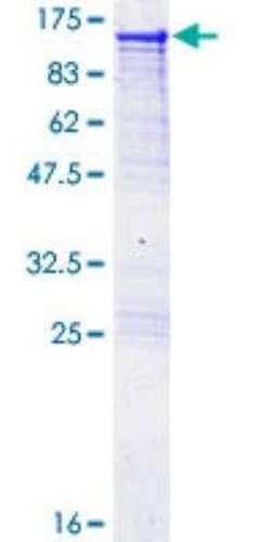 Novus Biologicals Recombinant Human Alanyl tRNA synthetase GST (N-Term) Protein 25 &mu;g | Buy Online | Novus Biologicals&trade; | Fisher Scientific