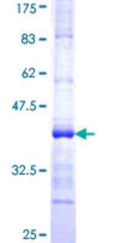 Novus Biologicals Recombinant Human Alas1 GST (N-Term) Protein 10 &mu;g | Buy Online | Novus Biologicals&trade; | Fisher Scientific