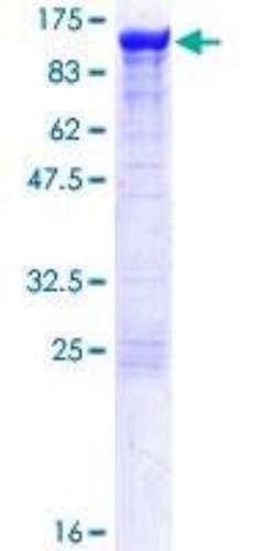 Novus Biologicals Recombinant Human Alpha Actinin 4 GST (N-Term) Protein 10 &mu;g | Buy Online | Novus Biologicals&trade; | Fisher Scientific
