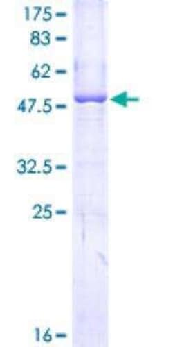 Novus Biologicals Recombinant Human Apolipoprotein L1 GST (N-Term) Protein 25 &mu;g | Buy Online | Novus Biologicals&trade; | Fisher Scientific
