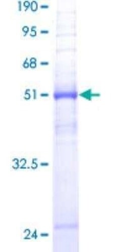 Novus Biologicals Recombinant Human Aquaporin-8 GST (N-Term) Protein 25 &mu;g | Buy Online | Novus Biologicals&trade; | Fisher Scientific