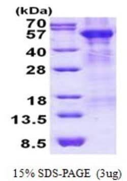 Novus Biologicals&trade;&nbsp;Recombinant Human Arylsulfatase A/ARSA His Protein