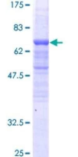 Novus Biologicals Recombinant Human BAF53A GST (N-Term) Protein 10 &mu;g | Buy Online | Novus Biologicals&trade; | Fisher Scientific