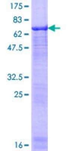 Novus Biologicals Recombinant Human BAF53A GST (N-Term) Protein 10 &mu;g | Buy Online | Novus Biologicals&trade; | Fisher Scientific