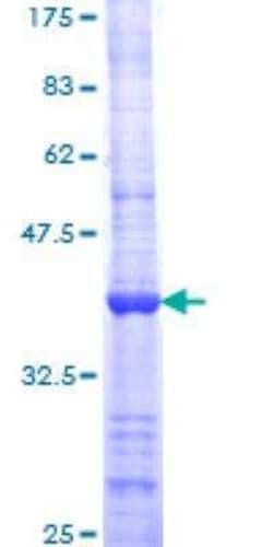 Novus Biologicals Recombinant Human BARD1 GST (N-Term) Protein 25 &mu;g | Buy Online | Novus Biologicals&trade; | Fisher Scientific