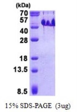 Novus Biologicals&trade;&nbsp;Recombinant Human BASP1 His Protein