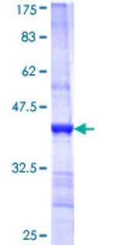 Novus Biologicals Recombinant Human BBS1 GST (N-Term) Protein 10 &mu;g | Buy Online | Novus Biologicals&trade; | Fisher Scientific