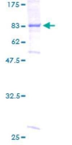 Novus Biologicals Recombinant Human BBS4 GST (N-Term) Protein 25 &mu;g | Buy Online | Novus Biologicals&trade; | Fisher Scientific