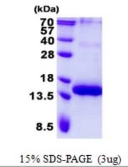 Novus Biologicals&trade;&nbsp;Recombinant Human BCMA/TNFRSF17 His Protein