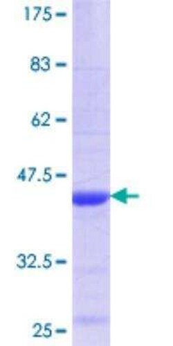 Novus Biologicals Recombinant Human BCR GST (N-Term) Protein 25 &mu;g | Buy Online | Novus Biologicals&trade; | Fisher Scientific