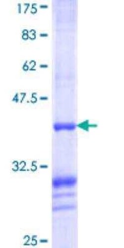Novus Biologicals Recombinant Human BCS1L GST (N-Term) Protein 25 &mu;g | Buy Online | Novus Biologicals&trade; | Fisher Scientific