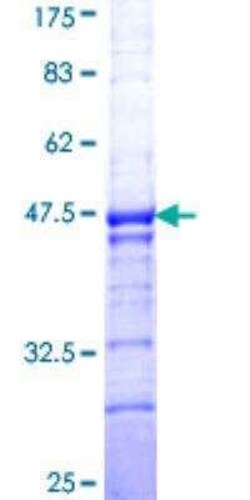 Novus Biologicals Recombinant Human BNC1 GST (N-Term) Protein 10 &mu;g | Buy Online | Novus Biologicals&trade; | Fisher Scientific
