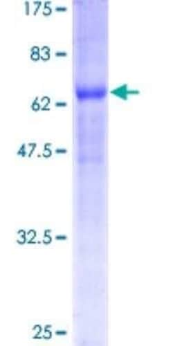 Novus Biologicals Recombinant Human BNIP2 GST (N-Term) Protein 10 &mu;g | Buy Online | Novus Biologicals&trade; | Fisher Scientific
