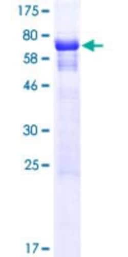 Novus Biologicals Recombinant Human BOD1L GST (N-Term) Protein 25 &mu;g | Buy Online | Novus Biologicals&trade; | Fisher Scientific
