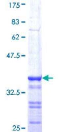 Novus Biologicals Recombinant Human BRCA1 GST (N-Term) Protein 25 &mu;g | Buy Online | Novus Biologicals&trade; | Fisher Scientific