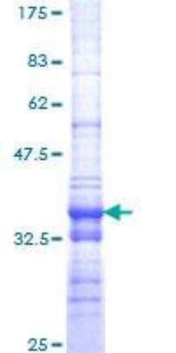 Novus Biologicals Recombinant Human BRM GST (N-Term) Protein 10 &mu;g | Buy Online | Novus Biologicals&trade; | Fisher Scientific
