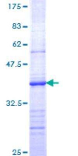 Novus Biologicals Recombinant Human BRS3 GST (N-Term) Protein 10 &mu;g | Buy Online | Novus Biologicals&trade; | Fisher Scientific