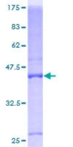Novus Biologicals Recombinant Human BTG1 GST (N-Term) Protein 25 &mu;g | Buy Online | Novus Biologicals&trade; | Fisher Scientific