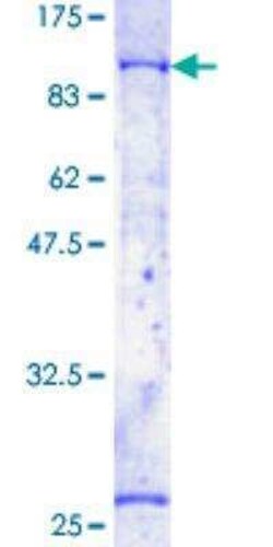 Novus Biologicals Recombinant Human BTK GST (N-Term) Protein 2 &mu;g | Buy Online | Novus Biologicals&trade; | Fisher Scientific