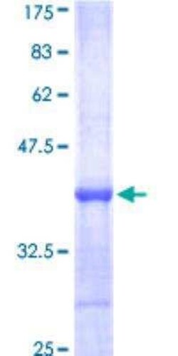Novus Biologicals Recombinant Human BTK GST (N-Term) Protein 25 &mu;g | Buy Online | Novus Biologicals&trade; | Fisher Scientific
