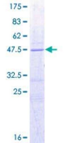 Novus Biologicals Recombinant Human Bad GST (N-Term) Protein 2 &mu;g | Buy Online | Novus Biologicals&trade; | Fisher Scientific