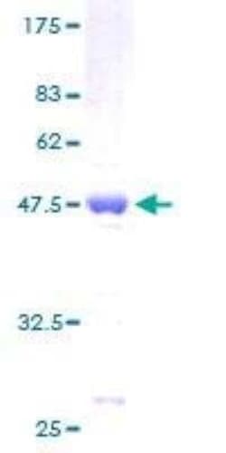 Novus Biologicals Recombinant Human Bax GST (N-Term) Protein 10 &mu;g | Buy Online | Novus Biologicals&trade; | Fisher Scientific
