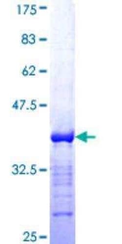 Novus Biologicals Recombinant Human Bcl-9 GST (N-Term) Protein 10 &mu;g | Buy Online | Novus Biologicals&trade; | Fisher Scientific