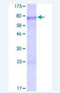 Novus Biologicals Recombinant Human Bcl3 GST (N-Term) Protein 10 &mu;g | Buy Online | Novus Biologicals&trade; | Fisher Scientific