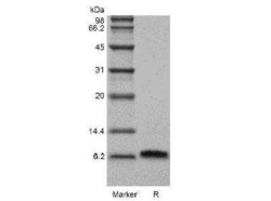 Novus Biologicals Recombinant Human Beta-Defensin 5 Protein 5 &mu;g | Buy Online | Novus Biologicals&trade; | Fisher Scientific