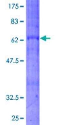 Novus Biologicals Recombinant Human Bradykinin RB2/BDKRB2 GST (N-Term) Protein 2 &mu;g | Buy Online | Novus Biologicals&trade; | Fisher Scientific