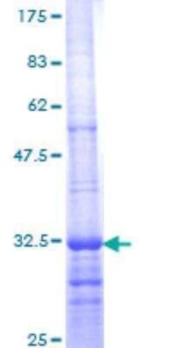 Novus Biologicals Recombinant Human Bradykinin RB2/BDKRB2 GST (N-Term) Protein 10 &mu;g | Buy Online | Novus Biologicals&trade; | Fisher Scientific
