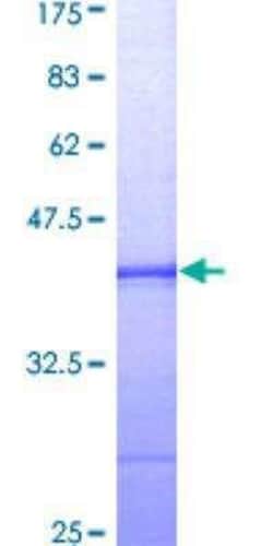 Novus Biologicals Recombinant Human Bub1 GST (N-Term) Protein 25 &mu;g | Buy Online | Novus Biologicals&trade; | Fisher Scientific