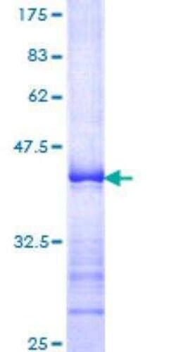 Novus Biologicals Recombinant Human BubR1 GST (N-Term) Protein 25 &mu;g | Buy Online | Novus Biologicals&trade; | Fisher Scientific