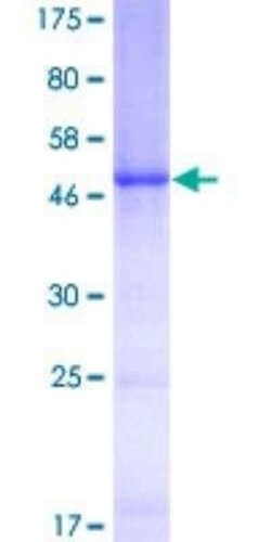 Novus Biologicals Recombinant Human C1QB GST (N-Term) Protein 10 &mu;g | Buy Online | Novus Biologicals&trade; | Fisher Scientific
