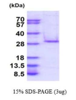 Novus Biologicals Recombinant Human C1qTNF5/CTRP5 His Protein 100 &mu;g | Buy Online | Novus Biologicals&trade; | Fisher Scientific
