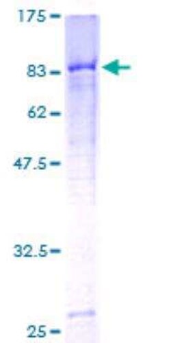 Novus Biologicals Recombinant Human C4 binding protein A GST (N-Term) Protein 10 &mu;g | Buy Online | Novus Biologicals&trade; | Fisher Scientific