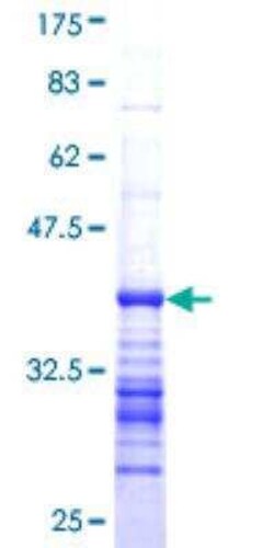 Novus Biologicals Recombinant Human CACNA1E GST (N-Term) Protein 25 &mu;g | Buy Online | Novus Biologicals&trade; | Fisher Scientific