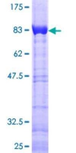 Novus Biologicals Recombinant Human CACNB3 GST (N-Term) Protein 25 &mu;g | Buy Online | Novus Biologicals&trade; | Fisher Scientific