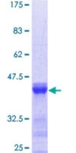 Novus Biologicals Recombinant Human CACNB4 GST (N-Term) Protein 25 &mu;g | Buy Online | Novus Biologicals&trade; | Fisher Scientific