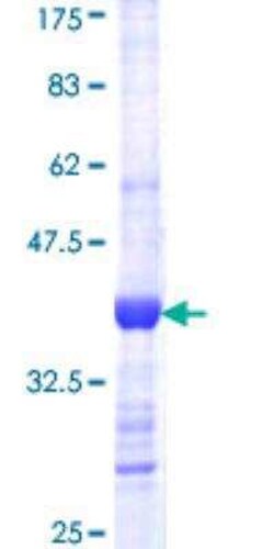 Novus Biologicals Recombinant Human CAPZA1 GST (N-Term) Protein 25 &mu;g | Buy Online | Novus Biologicals&trade; | Fisher Scientific