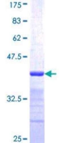 Novus Biologicals Recombinant Human CAPZB GST (N-Term) Protein 10 &mu;g | Buy Online | Novus Biologicals&trade; | Fisher Scientific