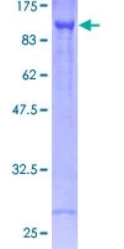 Novus Biologicals Recombinant Human CARS GST (N-Term) Protein 25 &mu;g | Buy Online | Novus Biologicals&trade; | Fisher Scientific