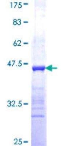 Novus Biologicals Recombinant Human CARS GST (N-Term) Protein 10 &mu;g | Buy Online | Novus Biologicals&trade; | Fisher Scientific