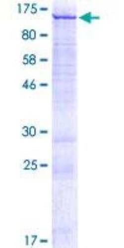 Novus Biologicals Recombinant Human CATSPER1 GST (N-Term) Protein 2 &mu;g | Buy Online | Novus Biologicals&trade; | Fisher Scientific