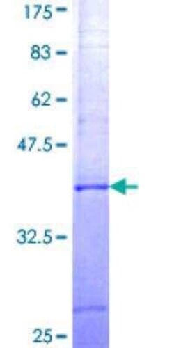 Novus Biologicals Recombinant Human CBFA2T3 GST (N-Term) Protein 25 &mu;g | Buy Online | Novus Biologicals&trade; | Fisher Scientific