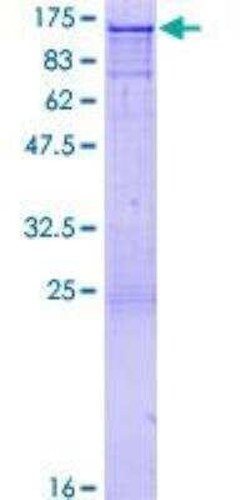 Novus Biologicals Recombinant Human CBL GST (N-Term) Protein 25 &mu;g | Buy Online | Novus Biologicals&trade; | Fisher Scientific