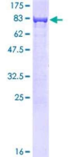 Novus Biologicals&trade;&nbsp;Recombinant Human CBS GST (N-Term) Protein