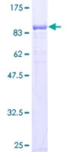 Novus Biologicals Recombinant Human CBS GST (N-Term) Protein 25 &mu;g | Buy Online | Novus Biologicals&trade; | Fisher Scientific